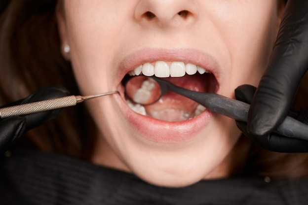 Periodontics dentistry