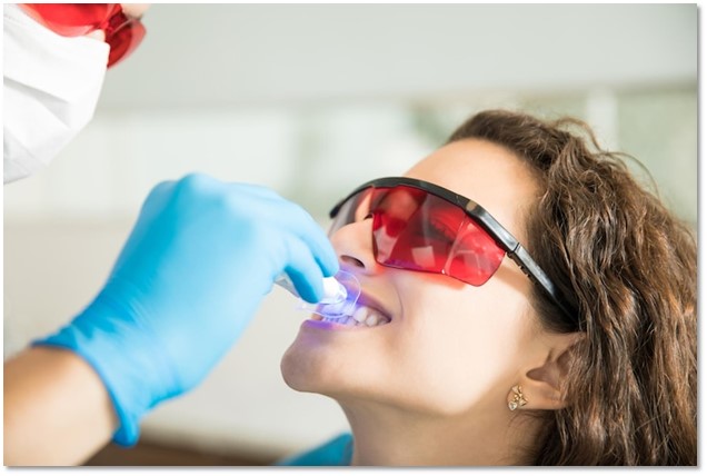 Professional Teeth Whitening